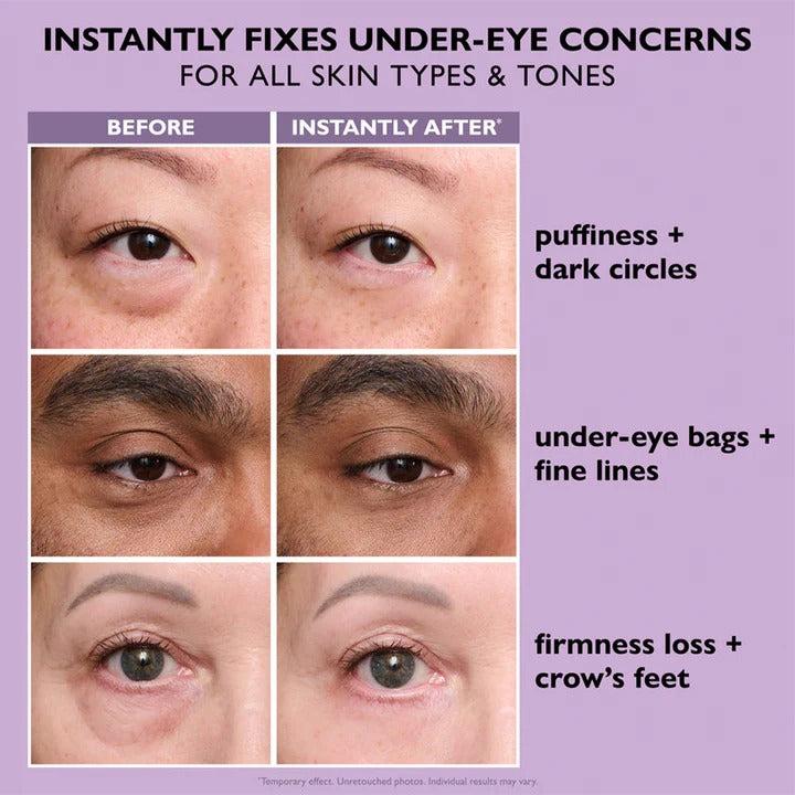 Eye Tightener